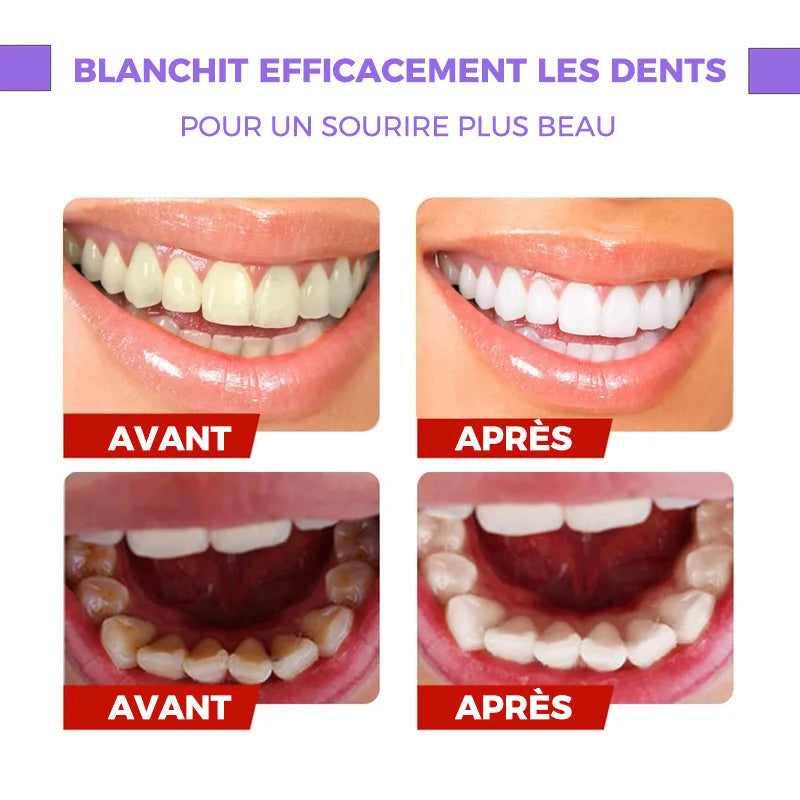 Sérum Correcteur de Couleur des Dents